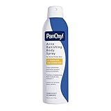 PanOxyl Acne Banishing Body Spray with 2% Salicylic Acid, Pimple Treatment Spray to Clear Stubborn Breakouts, 360-Degree Spray Nozzle, Skin-Brightening Niacinamide, Vitamin C, Witch Hazel, Aloe, 6 Oz